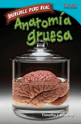 Increíble pero real: Anatomía gruesa (Strange but True: Gross Anatomy) (Spanish Version)